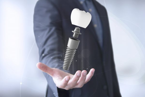 cuidar los implantes dentales