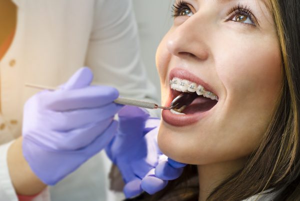 Stripping Dental